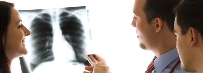 General xray procedure